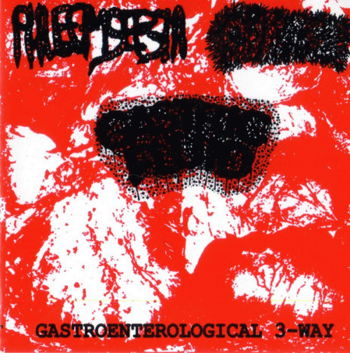 Gastric Fluid : Gastroenterological 3-Way